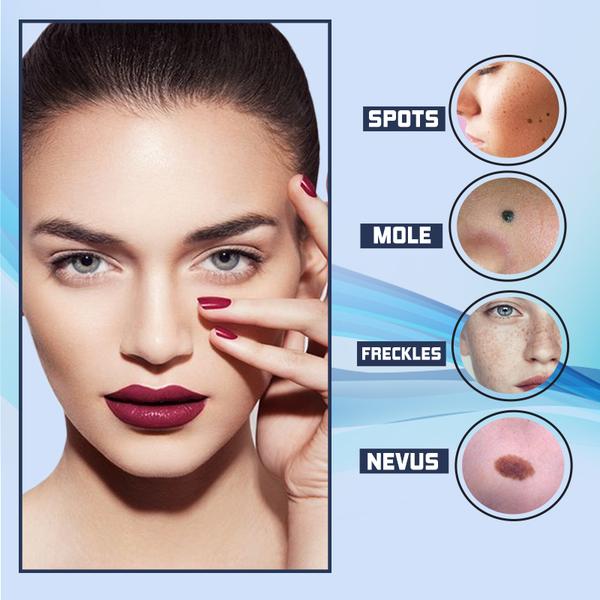 SpotPen™ - Freckle and Spots Removal Pen