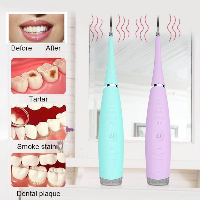 Ultrasonic Dental Cleaner Uses