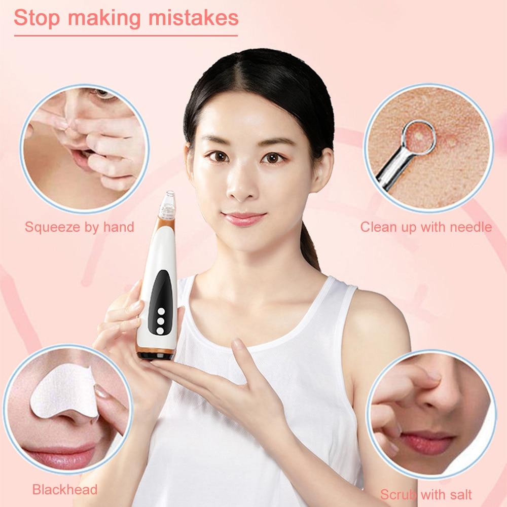 Premium Blackhead Remover