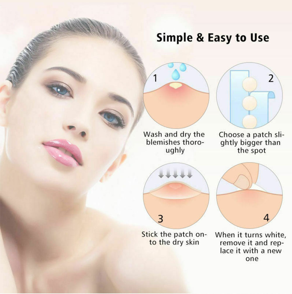 Skin Tag Remover Patches (36 PCS)